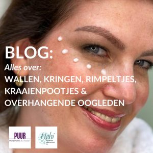 blog wallen rimpels kraaienpootjes ogen