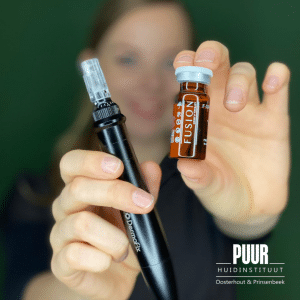 micro needling huidtherapeut tanja 