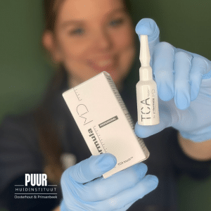 tca peeling puur 