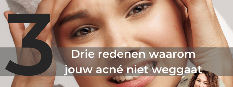drie redenen acne puistjes