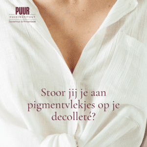 ACTIE IPL Decolleté PUUR Huidinstituut oosterhout breda prinsenbeek fotofacial