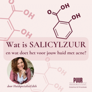 Wat is SALICYLZUUR en wat doet het voor jouw huid met acne? PUUR Huidinstituut oosterhout prinsenbeek edith Naaijkens PUUR Skin Solutions beauty blog salicylzuur