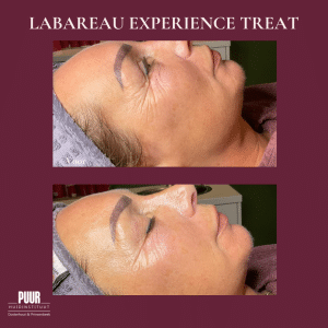 Labareau behandeling, 
Labareau gezichtsbehandeling, 
Labareau skincare, 
Labareau producten, 
Labareau ervaring en Labareau review, Natuurlijk bij PUUR!