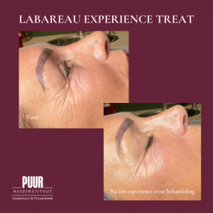 Labareau behandeling, 
Labareau gezichtsbehandeling, 
Labareau skincare, 
Labareau producten, 
Labareau ervaring en Labareau review, Natuurlijk bij PUUR!