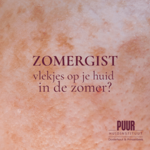 Zomergist lichte vlekjes op je huid in de zomer. Beauty blog door huidspecialiste Marijn van PUUR Huidinstituut Oosterhout breda prinsenbeek