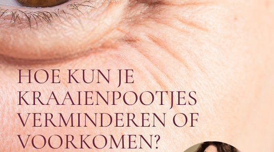 Hoe kun je kraaienpootjes verminderen of voorkomen? Bl;og door huidspecialist Edith van PUUR