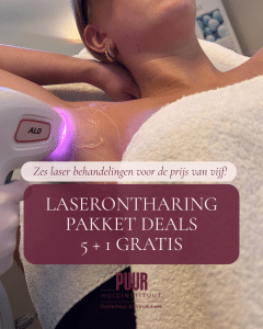 actie laserontharing PUUR Breda Prinsenbeek Oostetrhout Pakket actie 5+1 behandeling gratis