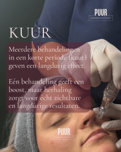 Huidverbetering bij PUUR Huidinstituut Breda Prinsenbeek en Oosterhout.