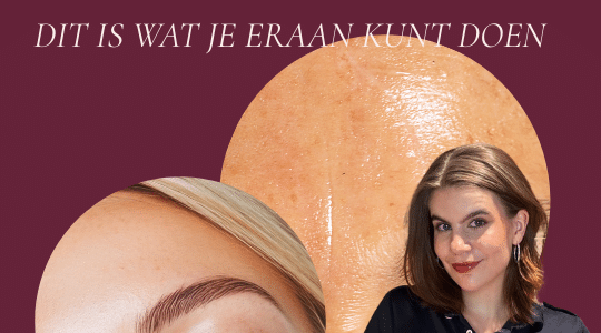Vettige glim versus frisse glow PUUR Huidinstituut beauty blog