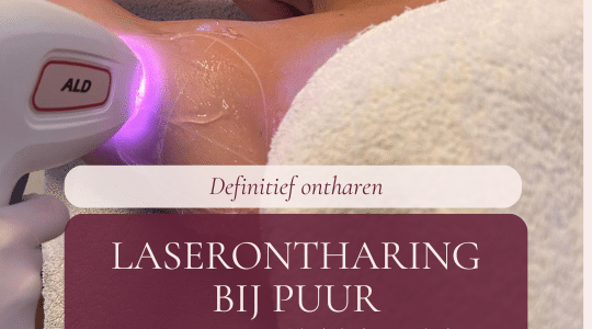 Definitief ontharen met laser in Brabant: Breda, Oosterhout en Prinsenbeek