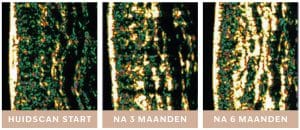 COLLAGEN VIP DAY PUUR Huidinstituut Prinsenbeek Labareau