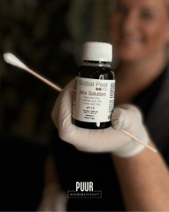 Jessner Peeling behandeling bij PUUR Huidinstituut Breda-Prinsenbeek & Oosterhout