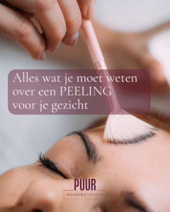 Alles wat je moet weten over een PEELING voor je gezicht. PUUR huidinstituut Breda, Prinsenbeek & Oosterhout