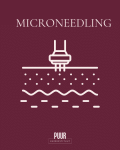 PUUR Huidinstituut Microneedling behandeling gezicht breda oosterhout en prinsenbeek