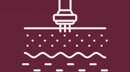 PUUR Huidinstituut Microneedling behandeling gezicht breda oosterhout en prinsenbeek