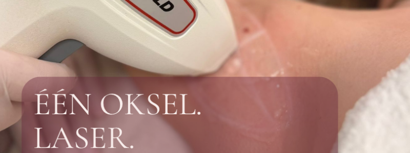 actie laserontharing breda prinsenbeek oosterhout Gratis oksel laser!